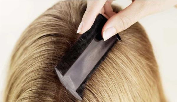 درمان شپش موی سر با ساده ترین روش ها